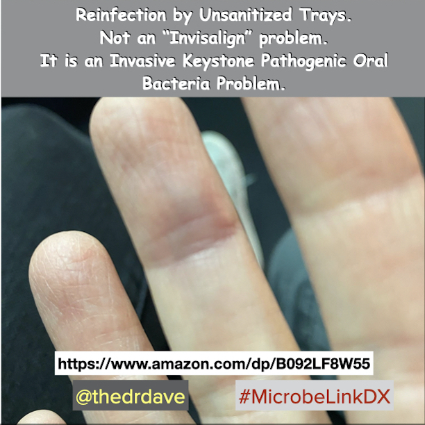 MicrobeLinkDX Oral DNA/PCR Bacterial Infection Test Kit - Image 3