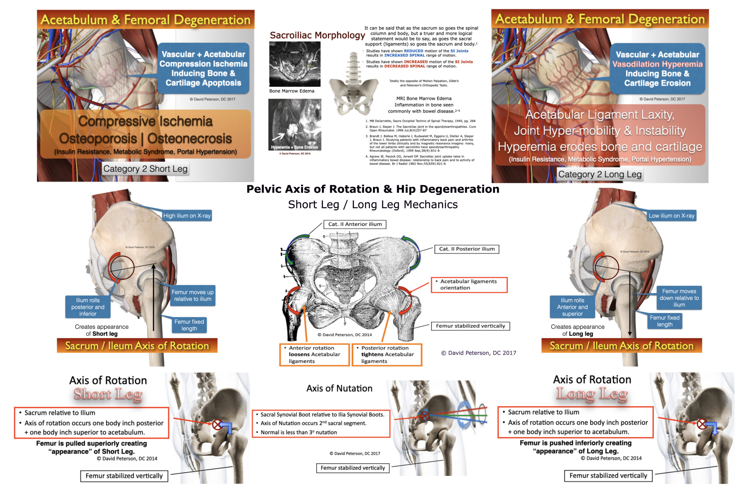 Pelvic Axis of Rotation & Hip Degeneration: Short Leg / Long Leg Mechanics - Image 3